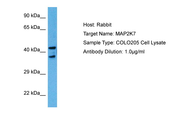 Host: Rabbit<br/>Target Name: MAP2K7<br/>Sample Tissue: Human COLO205 Whole Cell lysates<br/>Antibody Dilution: 1ug/ml