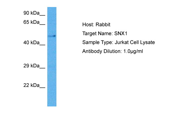 Host: Rabbit<br/>Target Name: SNX1<br/>Sample Tissue: Human Jurkat Whole Cell lysates<br/>Antibody Dilution: 1ug/ml