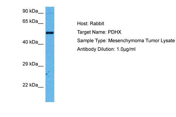 Host: Rabbit<br/>Target Name: PDHX<br/>Sample Tissue: Human Mesenchymoma Tumor lysates<br/>Antibody Dilution: 1ug/ml