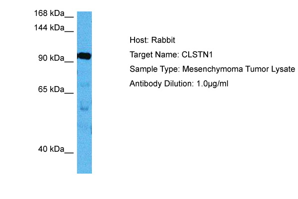 Host: Rabbit<br/>Target Name: CLSTN1<br/>Sample Tissue: Human Mesenchymoma Tumor lysates<br/>Antibody Dilution: 1ug/ml