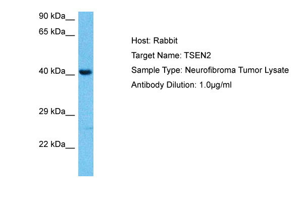 Host: Rabbit<br/>Target Name: TSEN2<br/>Sample Tissue: Human Neurofibroma Tumor lysates<br/>Antibody Dilution: 1ug/ml