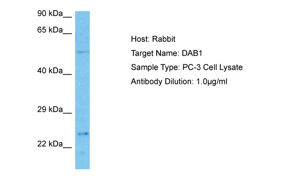 Host: Rabbit<br/>Target Name: DAB1<br/>Sample Tissue: Human PC-3 Whole Cell lysates<br/>Antibody Dilution: 1ug/ml