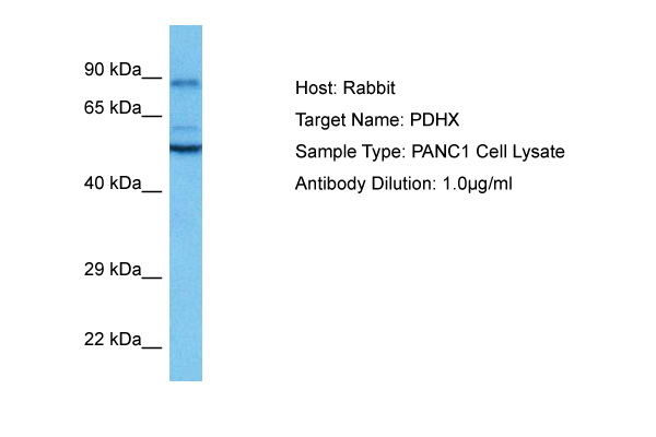 Host: Rabbit<br/>Target Name: PDHX<br/>Sample Tissue: Human PANC1 Whole Cell lysates<br/>Antibody Dilution: 1ug/ml