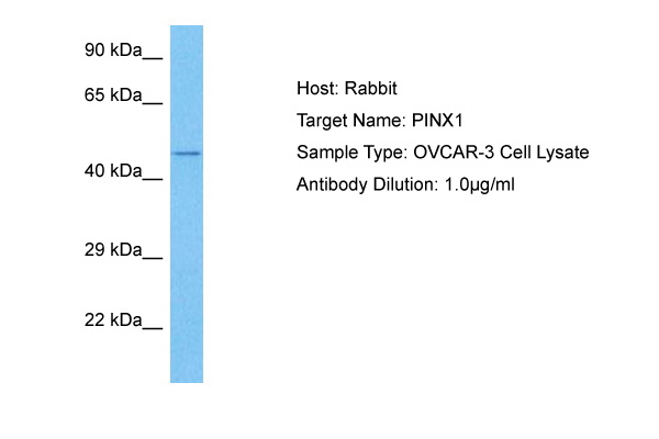 Host: Rabbit<br/>Target Name: PINX1<br/>Sample Tissue: Human OVCAR-3 Whole Cell lysates<br/>Antibody Dilution: 1ug/ml