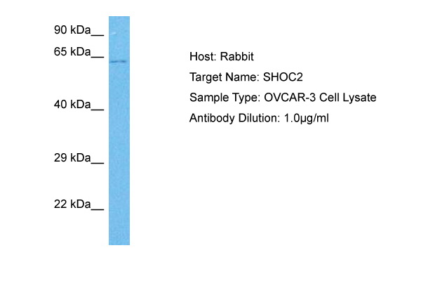 Host: Rabbit<br/>Target Name: SHOC2<br/>Sample Tissue: Human OVCAR-3 Whole Cell lysates<br/>Antibody Dilution: 1ug/ml