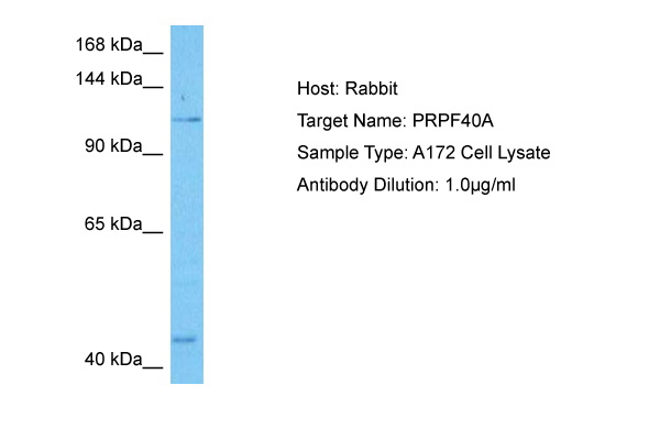 Host: Rabbit<br/>Target Name: PRPF40A<br/>Sample Tissue: Human A172 Whole Cell lysates<br/>Antibody Dilution: 1ug/ml