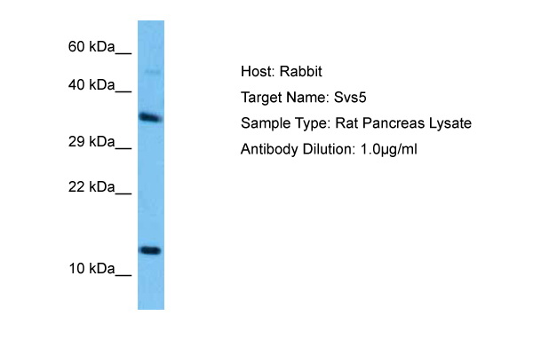 Host: Rabbit<br/>Target Name: SVS5<br/>Sample Tissue: Rat Pancreas lysates<br/>Antibody Dilution: 1ug/ml