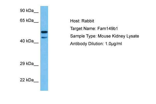 Host: Rabbit<br/>Target Name: FAM149B1<br/>Sample Tissue: Mouse Kidney lysates<br/>Antibody Dilution: 1ug/ml