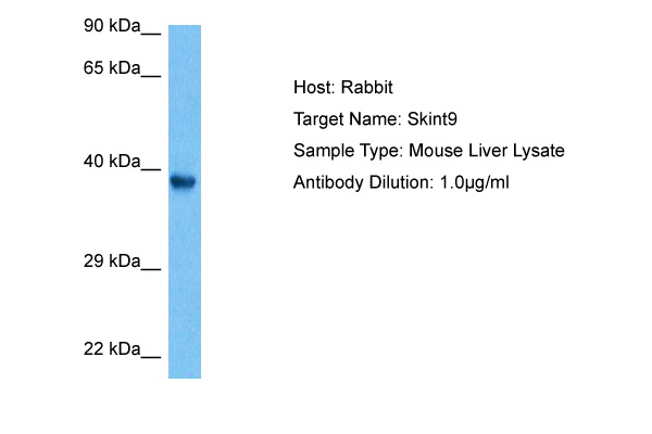 Host: Rabbit<br/>Target Name: SKINT9<br/>Sample Tissue: Mouse Liver lysates<br/>Antibody Dilution: 1ug/ml