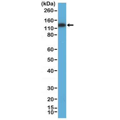 Western Blot of 293 cell lysate using Anti-MSH3 rabbit monoclonal antibody (Clone RM405) at a 1:800 dilution.