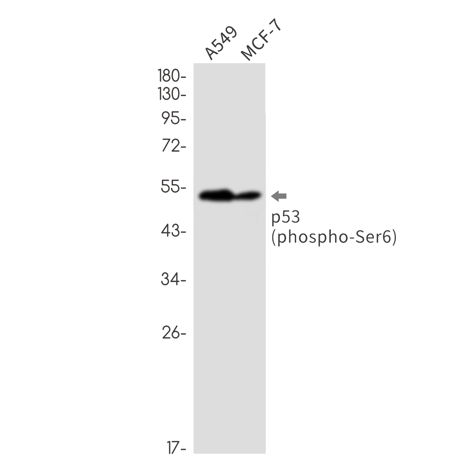 Phospho p53 (Ser6) Rabbit Monoclonal Antibody [Clone ID: R02-0F2]