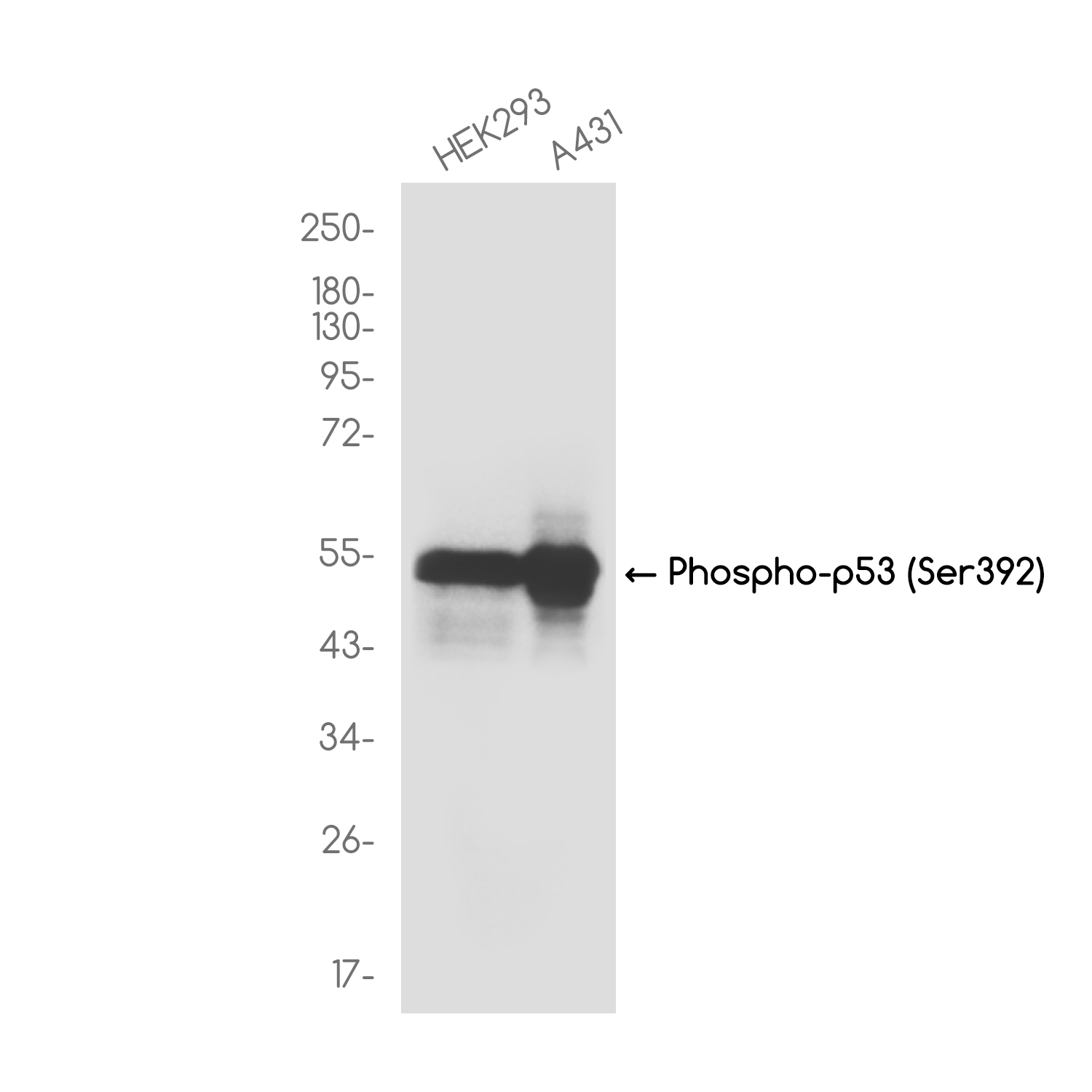 Phospho p53 (Ser392) Rabbit Monoclonal Antibody [Clone ID: R05-6O-5]