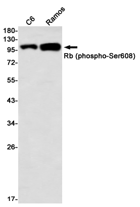 Phospho Rb (Ser608) Rabbit Monoclonal Antibody [Clone ID: R02-6C5 ...