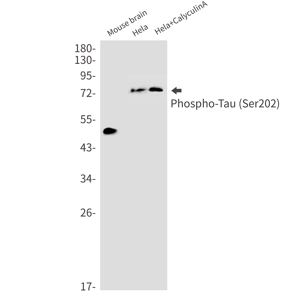 Western blot analysis of Phospho-Tau (Ser202) in mouse brain, Hela, Hela+CalyculinA lysates using Phospho-Tau (Ser202) antibody.