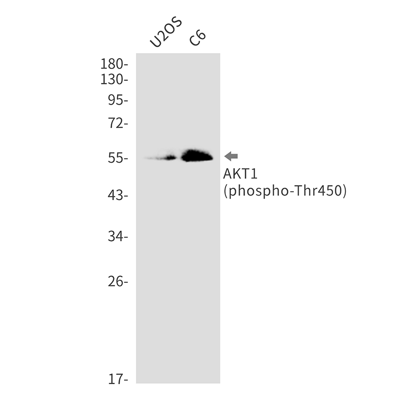 Phospho AKT1 (Thr450) Rabbit Monoclonal Antibody [Clone ID: R07-4A7]