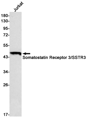 Western blot analysis of Somatostatin Receptor 3/SSTR3 in Jurkat lysates using Somatostatin Receptor 3 antibody.