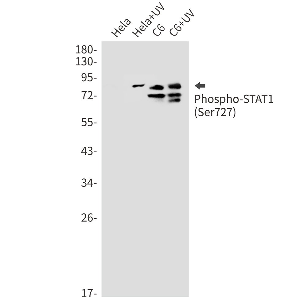 Phospho STAT1 (Ser727) Rabbit Monoclonal Antibody [Clone ID: R09-2G9]