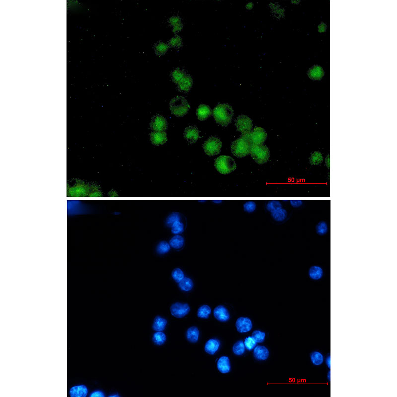 Immunocytochemistry analysis of MEF2A (green) in MCF-7 using MEF2A antibody,and DAPI(blue)
