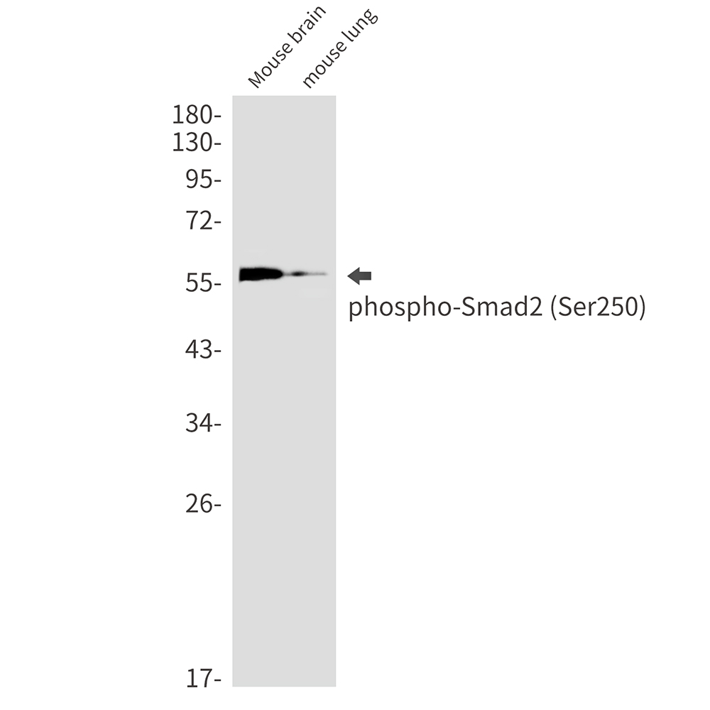 Western blot analysis of Phospho-Smad2 (Ser250) in mouse brain, mouse lung lysates using Phospho-Smad2 (Ser250) antibody.
