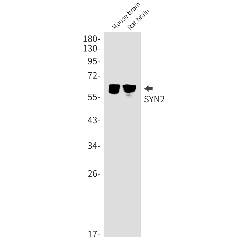 Synapsin II (SYN2) Rabbit Monoclonal Antibody [Clone ID: R07-0I5 ...