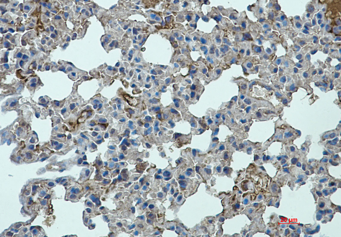 Immunohistochemistry analysis of paraffin-embedded mouse lung using STAT2 antibody.High-pressure and temperature Sodium Citrate pH 6.0 was used for antigen retrieval.