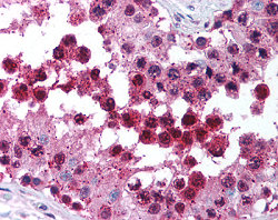 Human testis: Formalin-Fixed Paraffin-Embedded (FFPE).