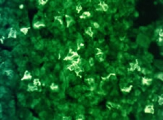 Staining with Beta-Endorphin Antibody 20063