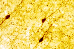 VIP Rabbit Polyclonal Antibody | 20077 | OriGene Technologies Inc.