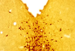 Staining with 5-HT (Serotonin) Goat Antibody 20079