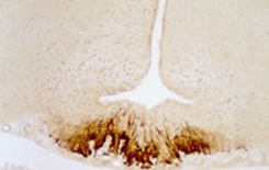 Staining with CRF (Corticotropin Releasing Factor) Antibody 20084
