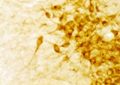 Staining with DBH (Dopamine-beta-Hydroxylase) Antibody 22806