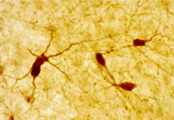Staining with Neuropeptide Y Antibody 22940