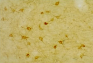 Staining of 5-HT (Serotonin) 2A Receptor Antibody 24288