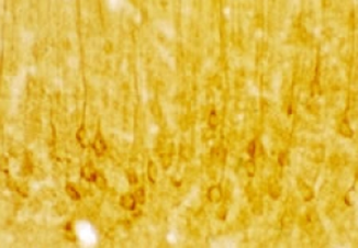 Staining with 5-HT (Serotonin) 7 Receptor Antibody 24430