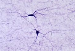 Staining with nNOS:N-Terminal (Neuronal Nitric Oxide Synthase) Antibody 24431