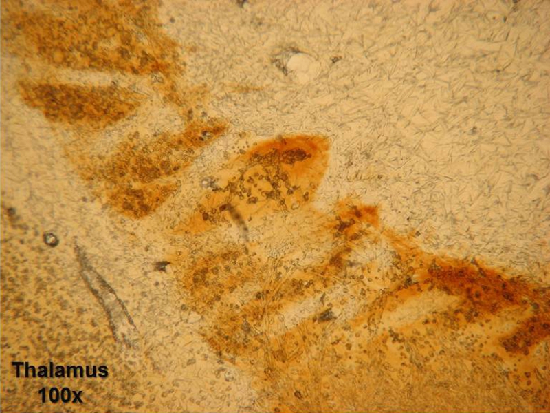 Staining with Substance P antibody