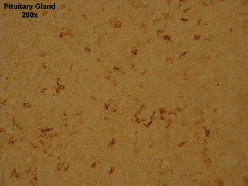 Staining with Melanocyte Stimulating Hormone (MSH alpha), Cat No 20074