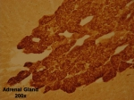 Staining with Vesicular Monoamine Transporter 1 (VMAT) Rabbit Antibody (82004)