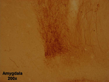 Staining with Neurokinin 1 Receptor Rabbit Antibody (20060)