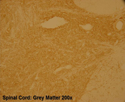 Staining with Vesicular Inhibitory Amino Acid Transporter (VIAAT) (20092)