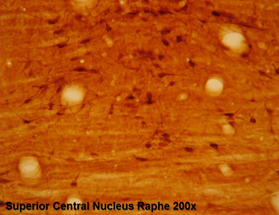 Staining with 5-HTP (5-Hydroxytryptophan) Antibody (24446)
