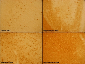 Calbindin D-28 Antibody (24427)