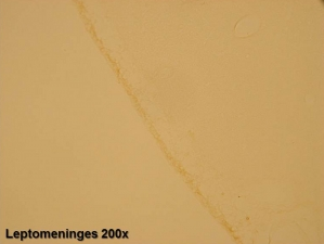 Staining with GAT-2 (Gamma Aminobutyric Acid Transporter) Antibody (24459)