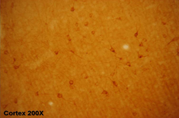 Staining with GluR1 (Ionotropic Glutamate Receptor 1) Antibody (24439)