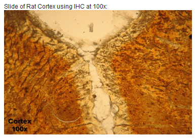 Staining with Parvalbumin Antibody (24428)