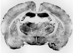 Staining with 5-HT (Serotonin) 2C Receptor Antibody (24505)