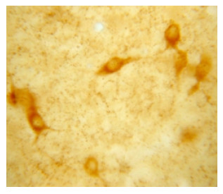 IHC image of neurons in the rat basal forebrain staining for VAT. The tissue was fixed with 4% formaldehyde in phosphate buffer, before being removed and prepared for vibratome sectioning. Floating sections were incubated at RT in 10% rabbit serum in PBS, before standard IHC procedure. Primary antibody was incubated at 1:5000 for 48 hours, rabbit anti-goat secondary was subsequently added for 1 hour after washing with PBS. Light microscopy staining was achieved with standard biotin-streptavidin/HRP procedure and DAB chromogen.