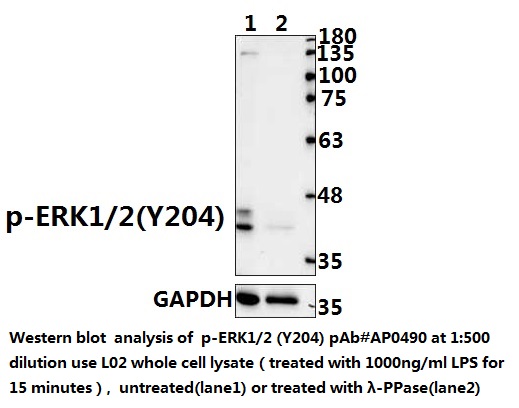 Phospho ERK1/2 (Tyr204) Rabbit Polyclonal Antibody