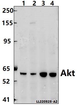 Western blot (WB) analysis of Akt (S473) polyclonal antibody at 1:1000 dilution
Lane1:Hela whole cell lysate(40ug)
Lane2:A549 whole cell lysate(40ug)
Lane3:PC12 whole cell lysate(40ug)
Lane4:BV2 whole cell lysate(40ug)