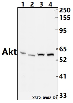 Western blot (WB) analysis of Akt (Ab-450) polyclonal antibody at 1:1000 dilution
Lane1:AML-12 whole cell lysate(40ug)                                                                                                                                                                                                      
Lane2:PC12 whole cell lysate(40ug)                                                                                         
Lane3:MCF-7 whole cell lysate(40ug)                                                                                          
Lane4:HepG2 whole cell lysate(40ug)